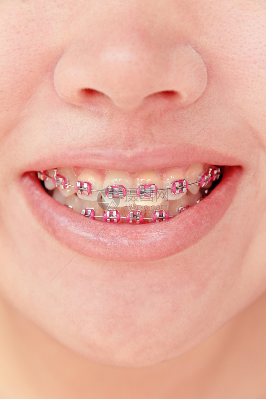 牙科概念设备宏观保健女性青少年卫生嘴巴牙齿人类笑脸图片