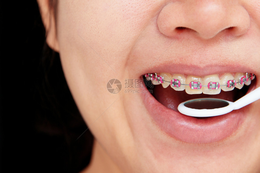 牙科概念牙医女性嘴巴女孩保健牙齿打扫设备医疗笑脸图片
