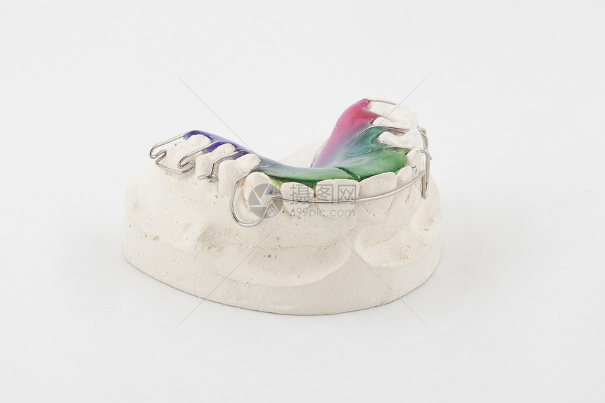 牙科板石膏工程金属植入物矫正技术假牙门牙假肢牙齿图片