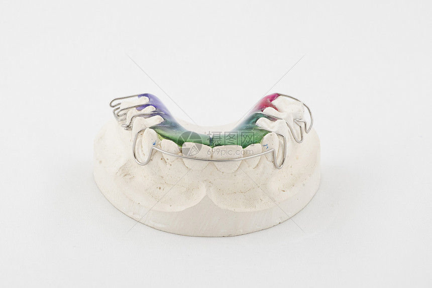 牙科板金属实验室假肢牙科工程桥梁植入物牙齿石膏技术图片