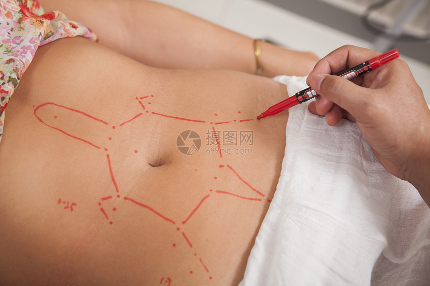 针刺治疗的绘图点Name女性医疗人体医学花卉摄影生活方式医生绘画混血图片