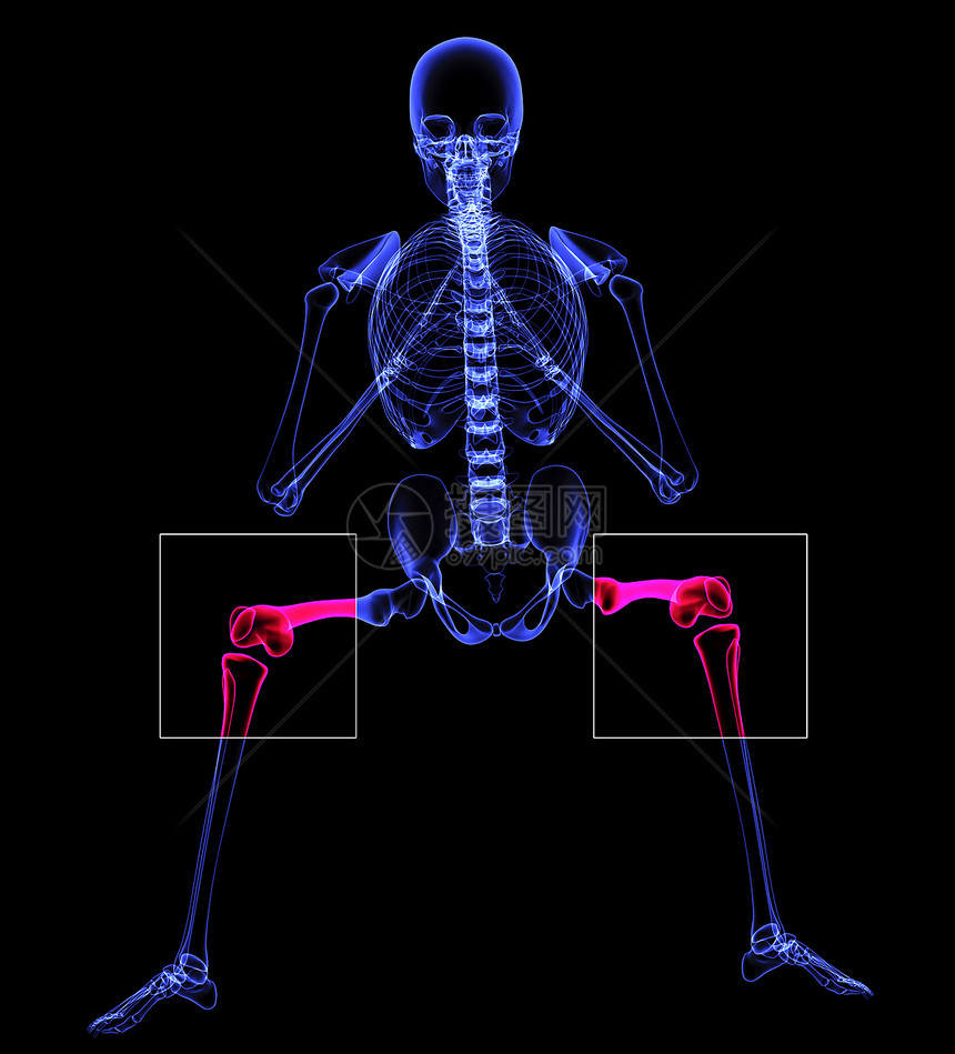 a 膝上运动图像医学关节膝盖x射线人体解剖学设备疼痛图片