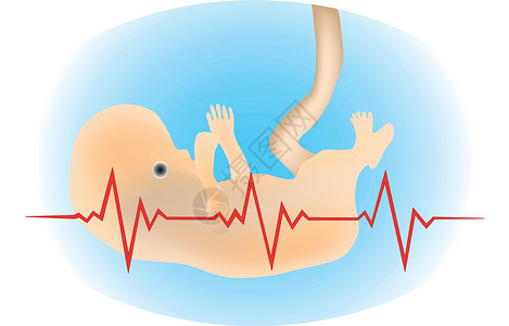 早产婴儿电图孩子心电图健康监控胚胎夹子早产儿生存早产海浪插画