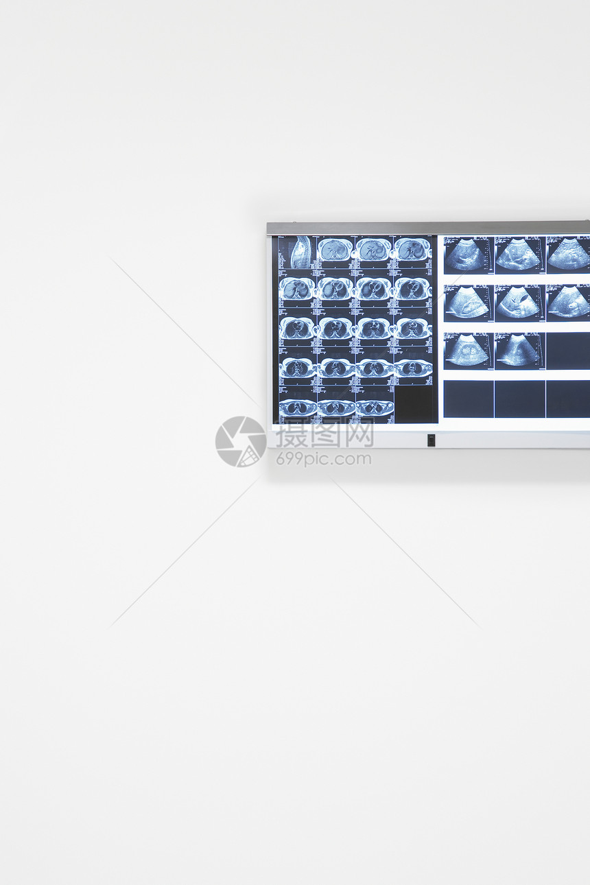 挂在墙上的X光和超声效果医学医疗保健x光医院科学超声波图片