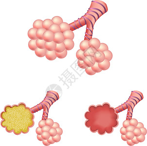 阿尔盖Alveoli 集成阿尔维奥利插画