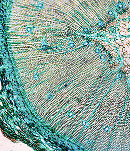 松木显微图木头宏观显微镜光显微科学细胞摄影照片幻灯片研究背景图片