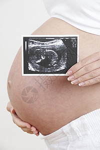 孕妇超声波扫描近距离接近检查背景图片