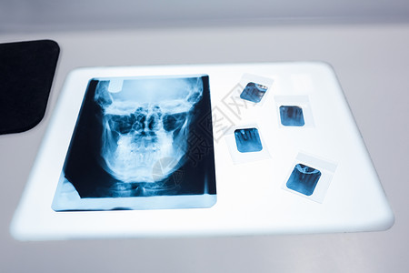 在桌子上近距离拍摄一张人头骨X光片医疗牙医医学颅骨口腔卫生诊所牙齿手术保健背景图片