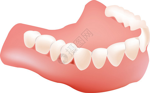 义齿低牙科牙植入器 低插画