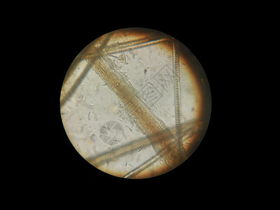皮肤癣一只显微镜 猫的毛发被损伤过皮质脱氧植物地衣挑衅损害传递性传染性动物园内皮孢子皮肤科真菌背景