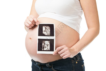展示超声波摄影照片的孕妇背景图片