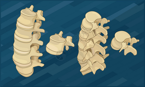 背痛骨骼人类脊椎骨平等度插画