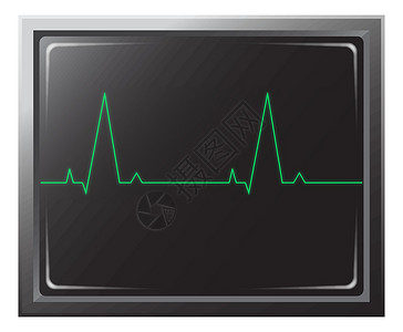 心脏病监测器空白白色医院插图医生屏幕医疗脉冲绿色监视器背景图片
