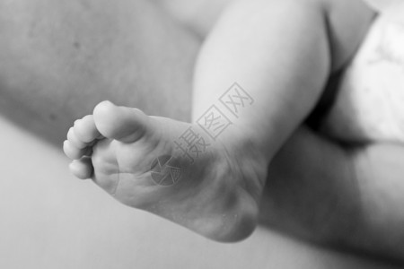 婴儿腿黑色压痛白色背景图片