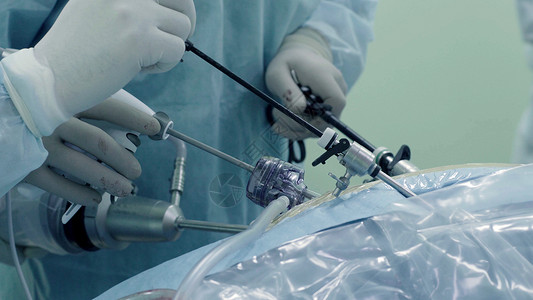 腹部的拉帕罗斯外科手术程序药品房间乐器实施病人身体保健蓝色腹腔镜背景