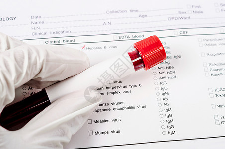 用于肝炎检测的手持血管微生物学血液学免疫学化学微生物病人发烧黄疸生物技术背景图片
