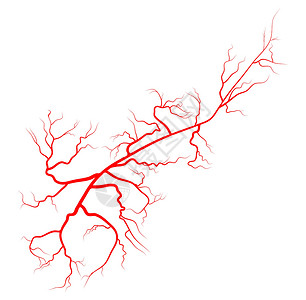 精索静脉曲张蜘蛛静脉矢量符号图标设计 美丽的插图我疾病流动硬化血管卫生女士树干静脉曲张标识疼痛插画