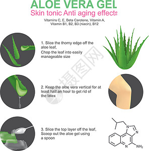 皮肤溃疡Aloe Vera凝胶 说明插画