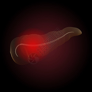脾胃运化X射线效果 具有疼痛点的胰腺病医学说明 点形体化插画