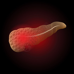 葡萄糖胺以医学为例 说明真器官的胰腺疾病 从带有炎点的线条到X射线效果都可达到X光效果插画