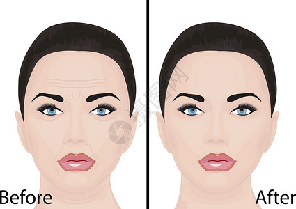 v脸提升年轻和衰老的面部皱纹治疗面部提升美容手术前后护肤矢量图设计图片