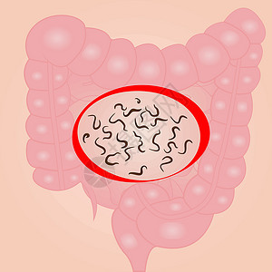 根结线虫在一个小小的肠子里插画