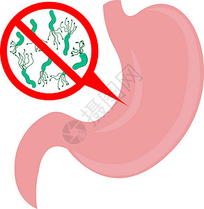 追溯系统停止胃中的幽门螺杆菌肠胃空气毒素胃炎消化症状气味细菌消化系统气体插画