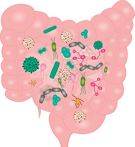 肠易激综合征停止小肠矢量插图中的细菌过度增长( U)设计图片