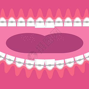 造口护理牙齿 牙科护理背景 矫形治疗 卡通开胃口医生金属药品诊所牙医工具嘴唇医院支撑牙刷插画