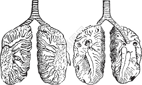 鸽子复古插图的肺背景图片