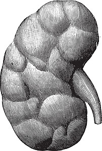 胎儿肾 旧式插图背景图片