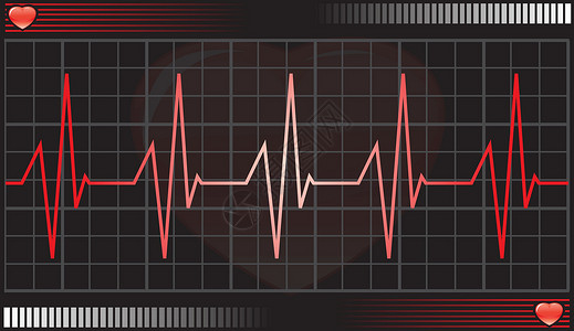 心跳监测器 插图医院生活绘画治疗统计情况速度脉冲考试设计图片