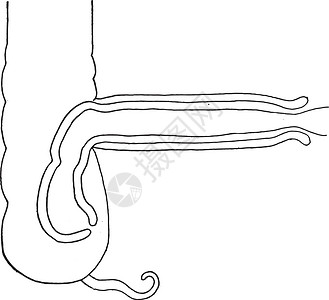 肠套叠用于显示 sev 关系的 Intsus 感知图插画