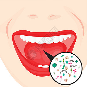 缩唇呼吸口腔细菌过度生长疾病病人流感咳嗽卫生感染牙科治疗药品微生物插画