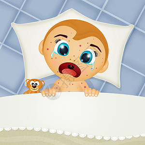 患有麻疹的婴儿插图药品疾病注射眼泪皮肤烦恼感染孩子康复背景图片