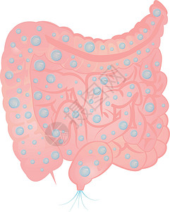肠内胀气和过量气体细菌腹胀卫生疾病胃肠病毒素寄生虫消化消化系统空气插画