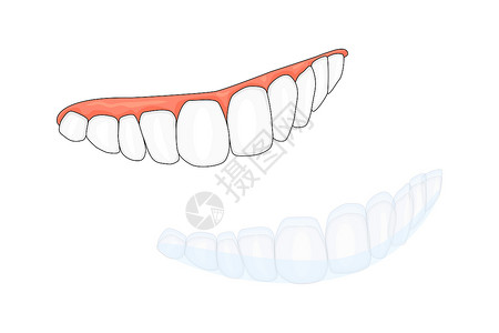 白色背景中隔离的牙齿和隐形牙套或隐形固定器插画