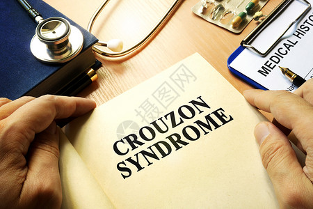 书名是Crouzon综合症 放在桌子上背景图片