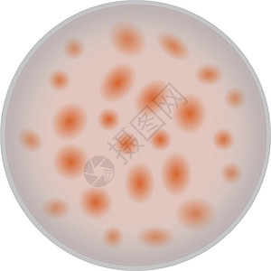 灵敏度抗生素敏感性试验设计图片