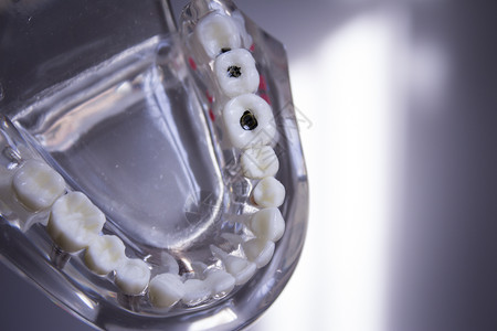 透明学生假牙牙科模仿医疗水晶生活牙医考试白色解剖学背景图片