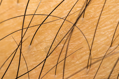 黑发亚洲人干性皮肤宏观生活肤色卫生身体细胞皮肤科男人头发男性器官背景