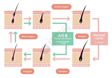 脂溢性脱发正常毛发周期与AGA雄激素性脱发的对比图生长细胞解剖学脱发化期头皮沙龙身体卫生乳突插画