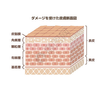 它制作图案损坏的皮肤层药品治疗插图卫生护理障碍皮脂表皮身体角质层背景图片