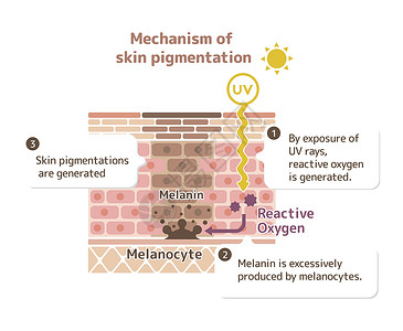 皮肤色素沉着皮肤斑点图案制作机制皮肤科过敏表皮粉刺插图老化器官素沉着卫生组织设计图片