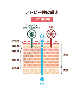 皮肤瘙痒特应性皮炎载体它制作图案的剖面图皮炎解剖学护理插图卫生过敏瘙痒损害保健医生插画