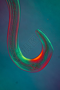 湿疣微生物底部的氧化性寄生虫100x蛲虫考试棕色钩虫弯曲黑头口器蠕虫科学宏观背景