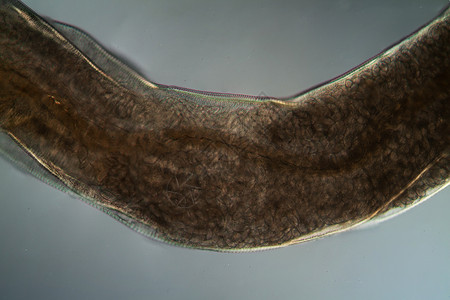 湿疣微生物底部的氧化性寄生虫100x蠕虫害虫考试感染口器黑头弯曲宏观疾病钩虫背景