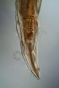 微生物底部的氧化性寄生虫100x钩虫宏观害虫疾病弯曲口器科学考试蛲虫黑头背景