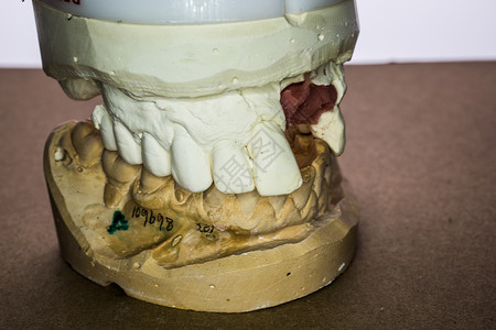 假印花牙齿假牙臼齿牙医维修门牙治疗牙列牙科假肢背景图片