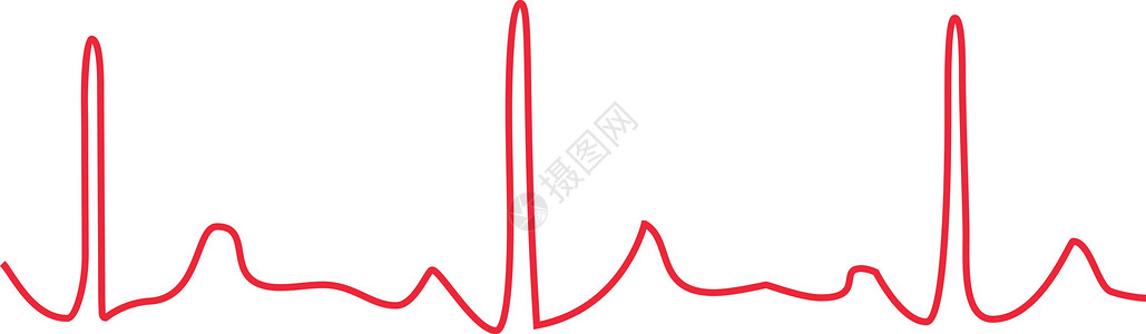 心电监护仪白色背景的中心红图心脏脉冲健康有氧运动心脏病学监护仪速度插画